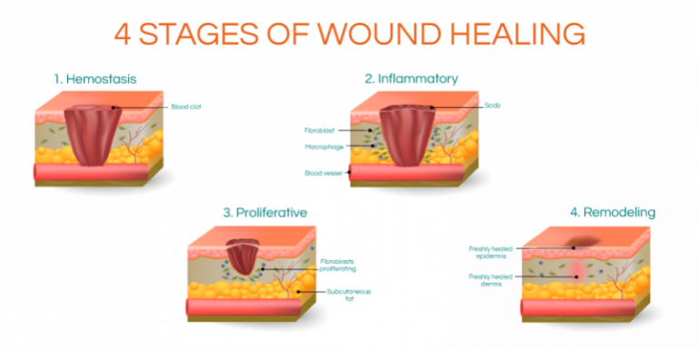 Wound Care | Unified Health