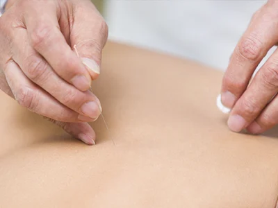 Close-up of a person's back during an acupuncture session. A practitioner's hands are seen gently inserting a thin needle into the skin while holding a cotton ball, highlighting its role in pain management. The background is softly blurred, emphasizing the precise and careful nature of the procedure.