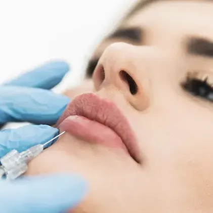 A close-up of a person receiving a lip injection. The person lies back with their face tilted upward, while a hand wearing blue medical gloves carefully injects a substance into their upper lip using a syringe.