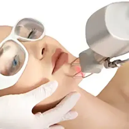 A person is receiving a laser beauty treatment on their lips. The person is wearing protective eyewear, and a hand in white gloves is holding their chin. The laser device is aimed at the person's lips, emitting a small beam of light.